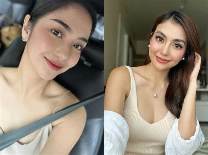 
Charlie Dizon Before Surgery | Filipino Actress Plastic Surgery Transformation 