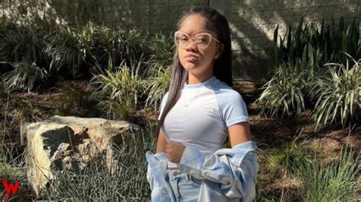 Does Khali Spraggins Have A Scar In Her Forehead? Her Disability And Wikipedia Bio