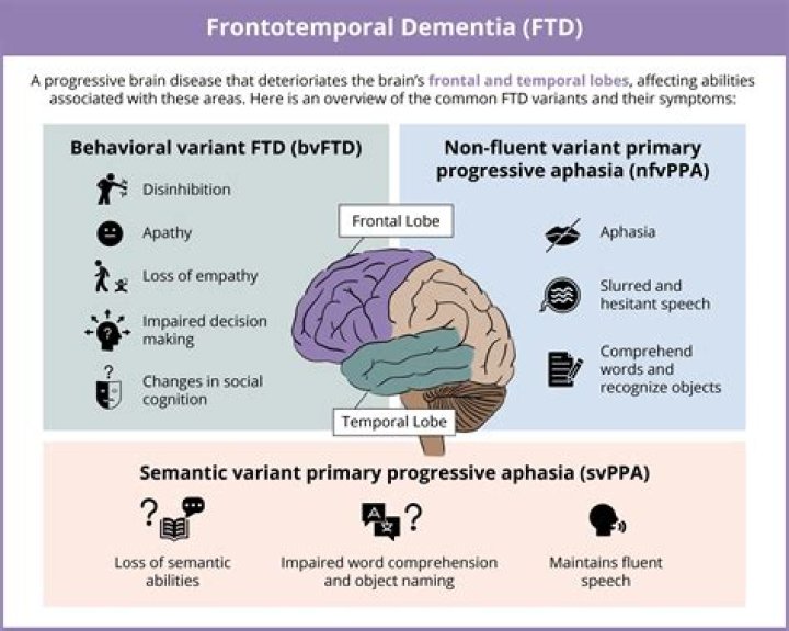 
Frontotemporal dementia life expectancy explored as Bruce Willis diagnosis sparks wave of support 