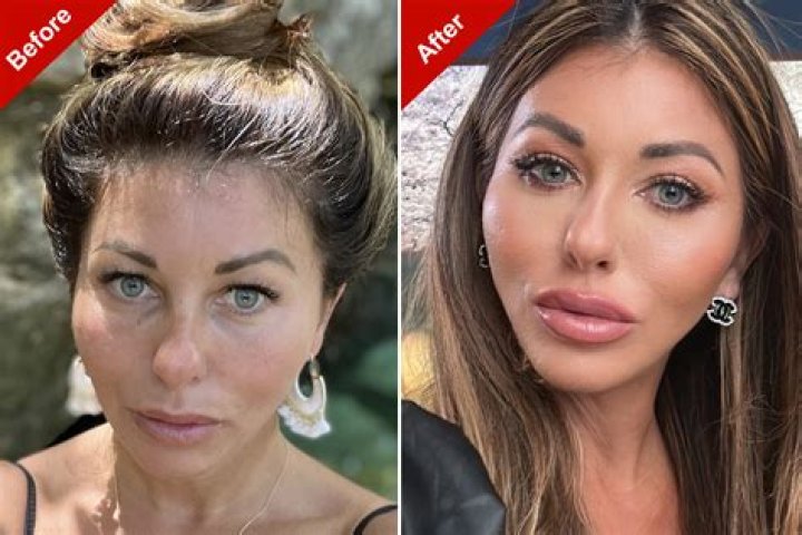 
Has Hannah Elizabeth had Plastic Surgery? Who is Hannah Elizabeth? 