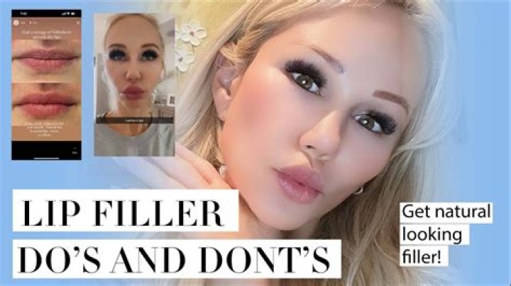 
Has Youtuber Desi Perkins Done Nose Job? Fans Curious About Lip Fillers And Botox 