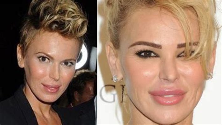 Here Is What Diana Jenkins Looked Like Before Plastic Surgery