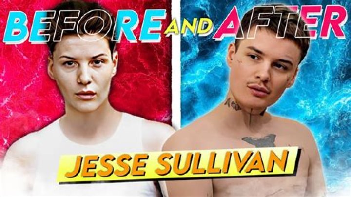 Jesse Sullivan Before And After Surgery, Gender And Age Revealed