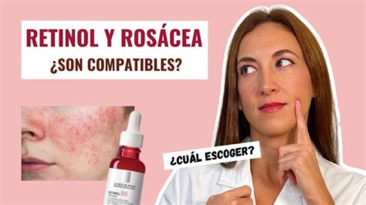 
Rosatil Para Que Sirve TikTok – What Is Rosatil Pomada? 