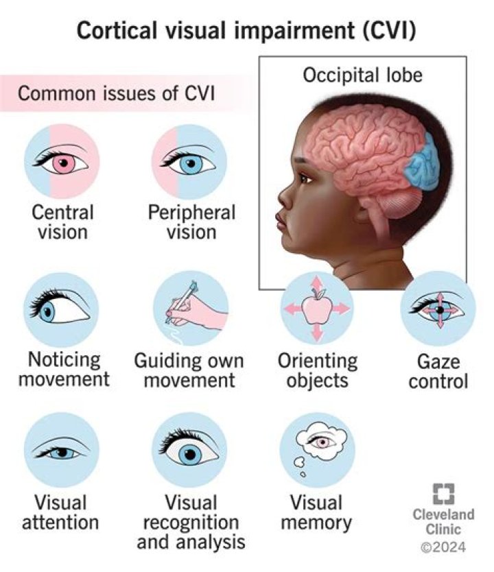 
Tamzyn, beautiful girl who suffers from Cerebral Palsy and Cortical Visual Impairment died 