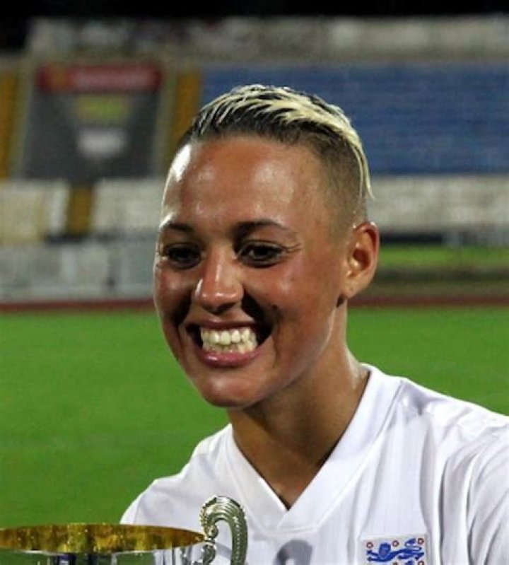 
What Happened To Lianne Sanderson’s Teeth? English Footballer New Look Explored 